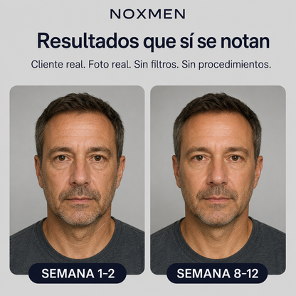 Crema de Noche para Hombre 40+ | Rostro y Cuello